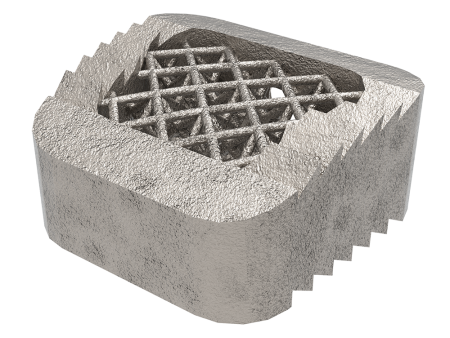 Tra-Ti Trabecular Cervical Cage