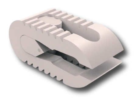 Alligator-Exp Plif Expandable Peek Cage