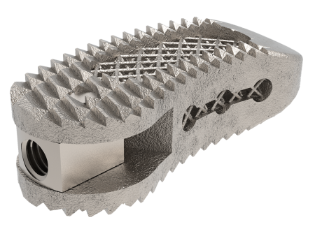 Tra-Ti Trabecular Tlif Cage