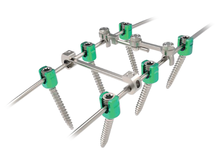 Rapidfix Dual Lead Thoracolumbar Screws