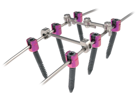 Quatro Quad Lead Thoracolumbar Screws