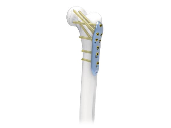 Pioneer Cannulated Locking Screw Instrument Set Screws